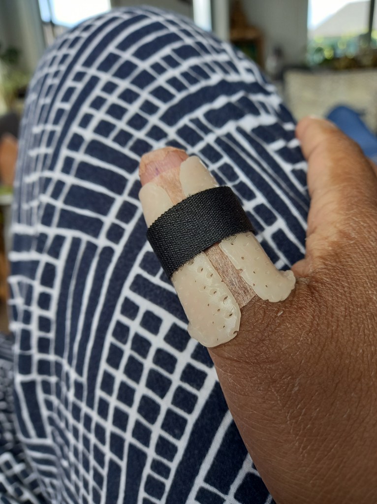 Thumb in yellow splint. checked material behind.